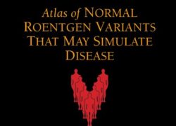 Atlas of Normal Roentgen Variants That May Simulate Disease