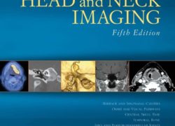 Head and Neck Imaging (Expert Consult)