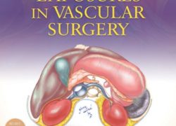 Anatomic Exposures in Vascular Surgery