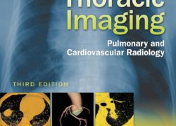 Thoracic Imaging: Pulmonary and Cardiovascular Radiology